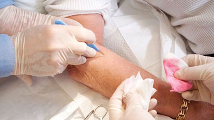 Minor Procedures & Surgery at Klinik Vistara Healthcare, Klang